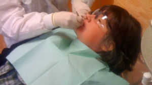 Dental Care for Disabled Dental Care for Disabled